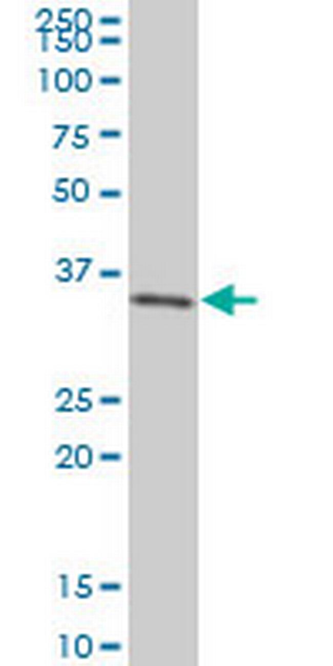 SIX3 Antibody in Western Blot (WB)