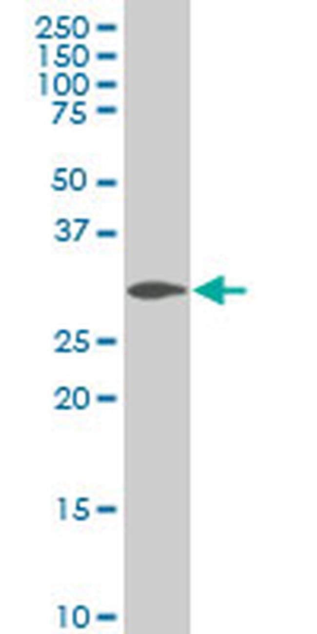 SIX3 Antibody in Western Blot (WB)