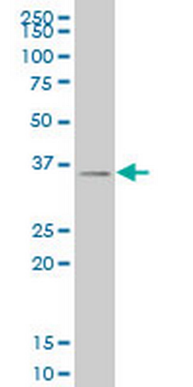 SIX3 Antibody in Western Blot (WB)