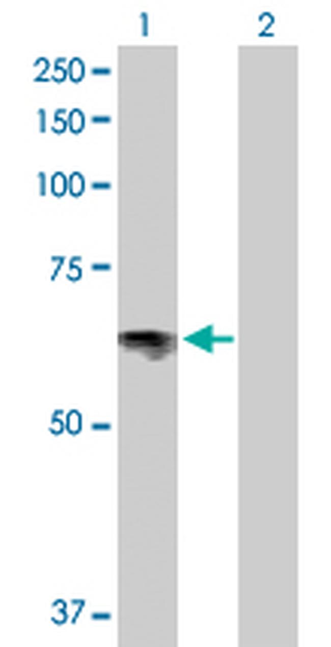 SLC6A4 Antibody in Western Blot (WB)