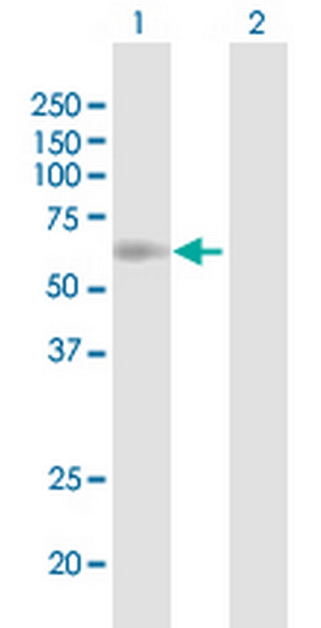 SLC7A1 Antibody in Western Blot (WB)