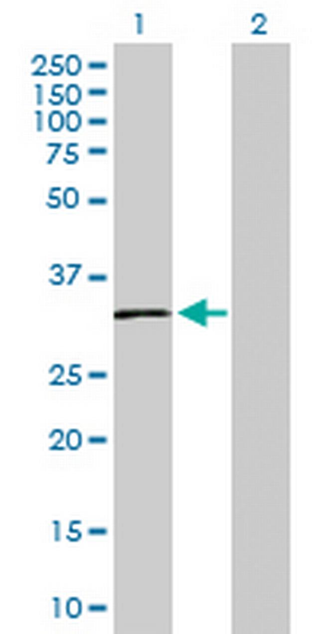 SLC14A1 Antibody in Western Blot (WB)