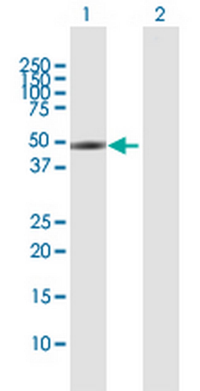 SLC16A1 Antibody in Western Blot (WB)