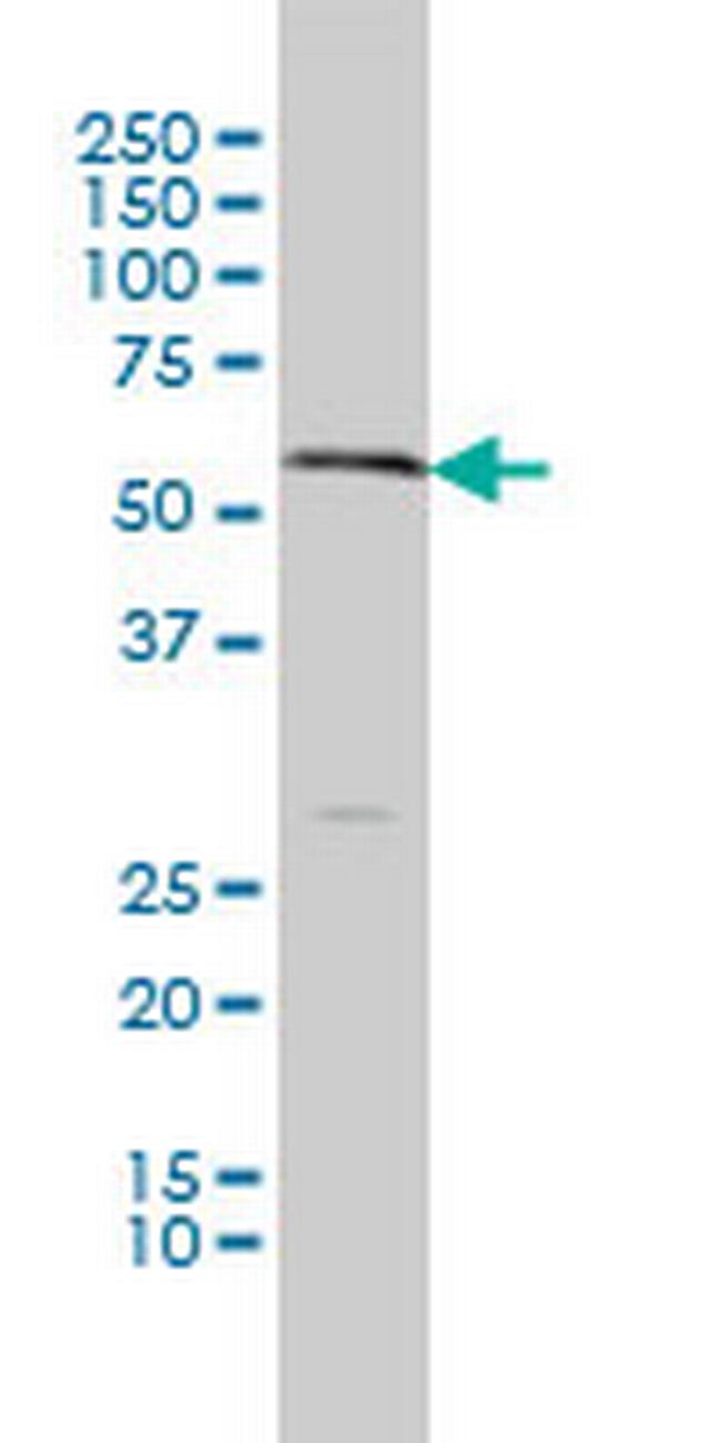 SLC18A1 Antibody in Western Blot (WB)