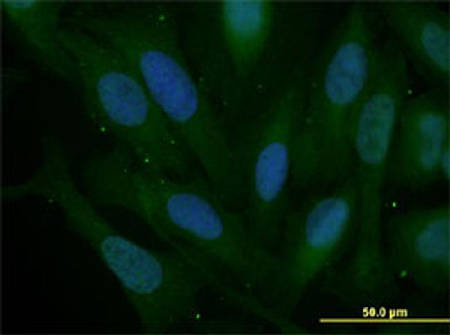 SNAI2 Antibody in Immunocytochemistry (ICC/IF)