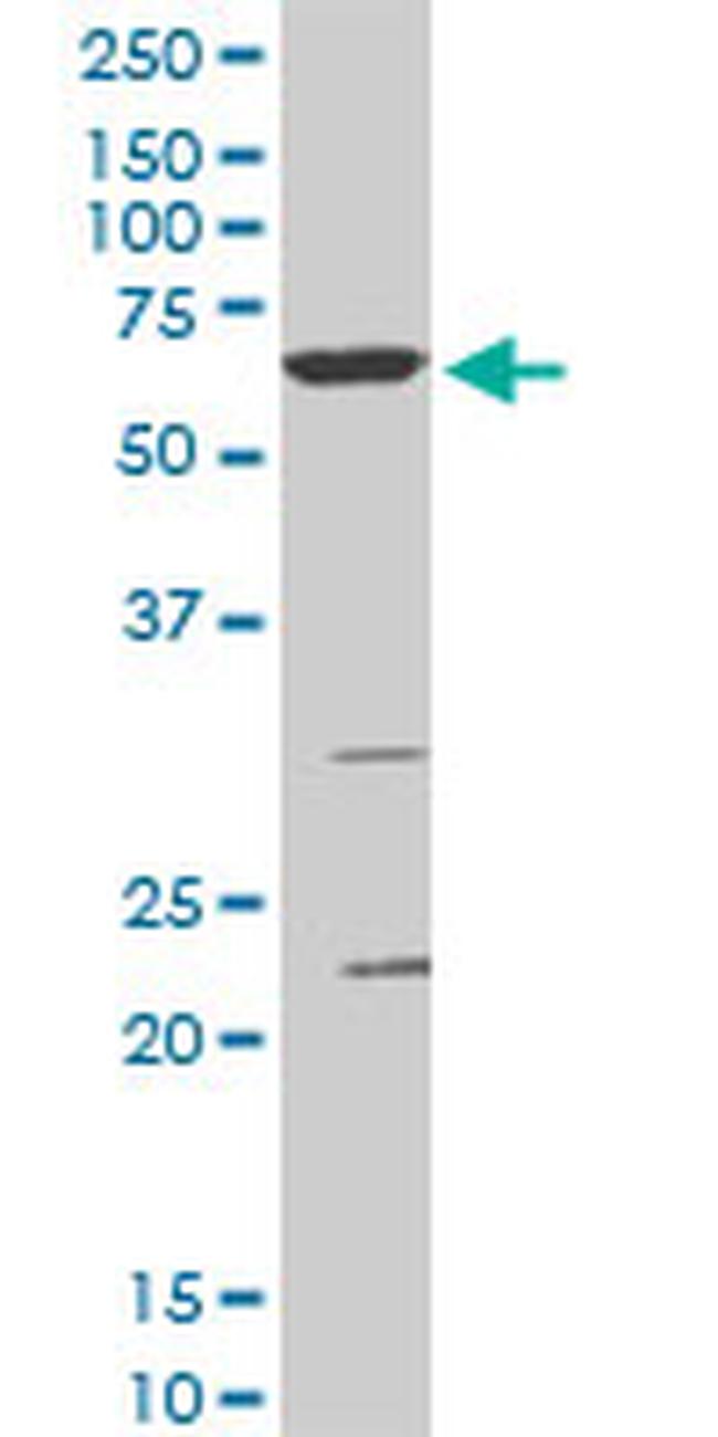 SMARCD3 Antibody in Western Blot (WB)