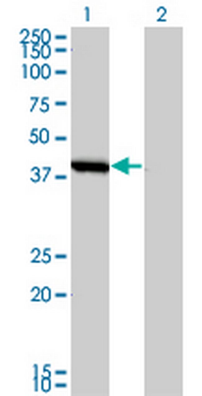 SMS Antibody in Western Blot (WB)