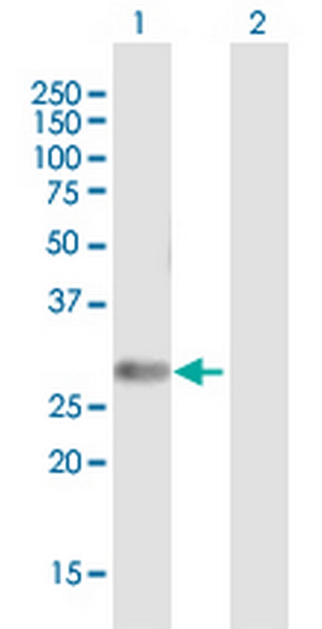 SNAI1 Antibody in Western Blot (WB)