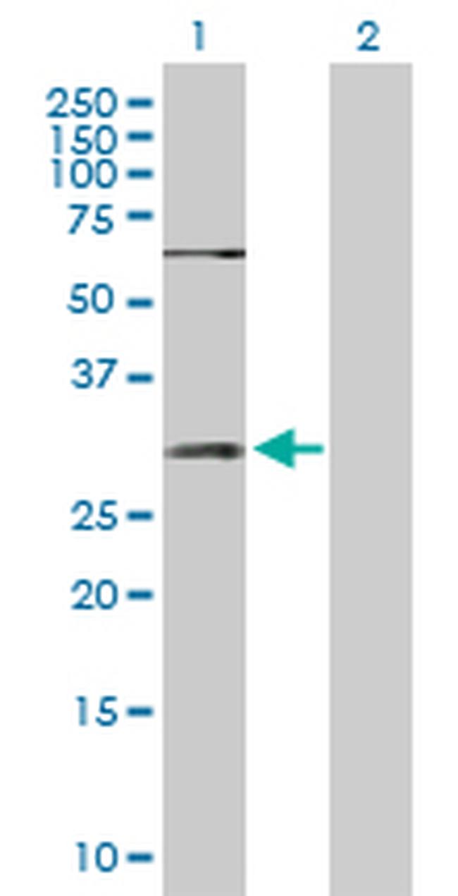 SNAI1 Antibody in Western Blot (WB)