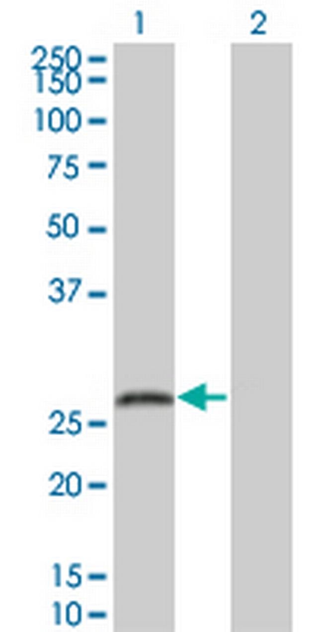 SNAP25 Antibody in Western Blot (WB)