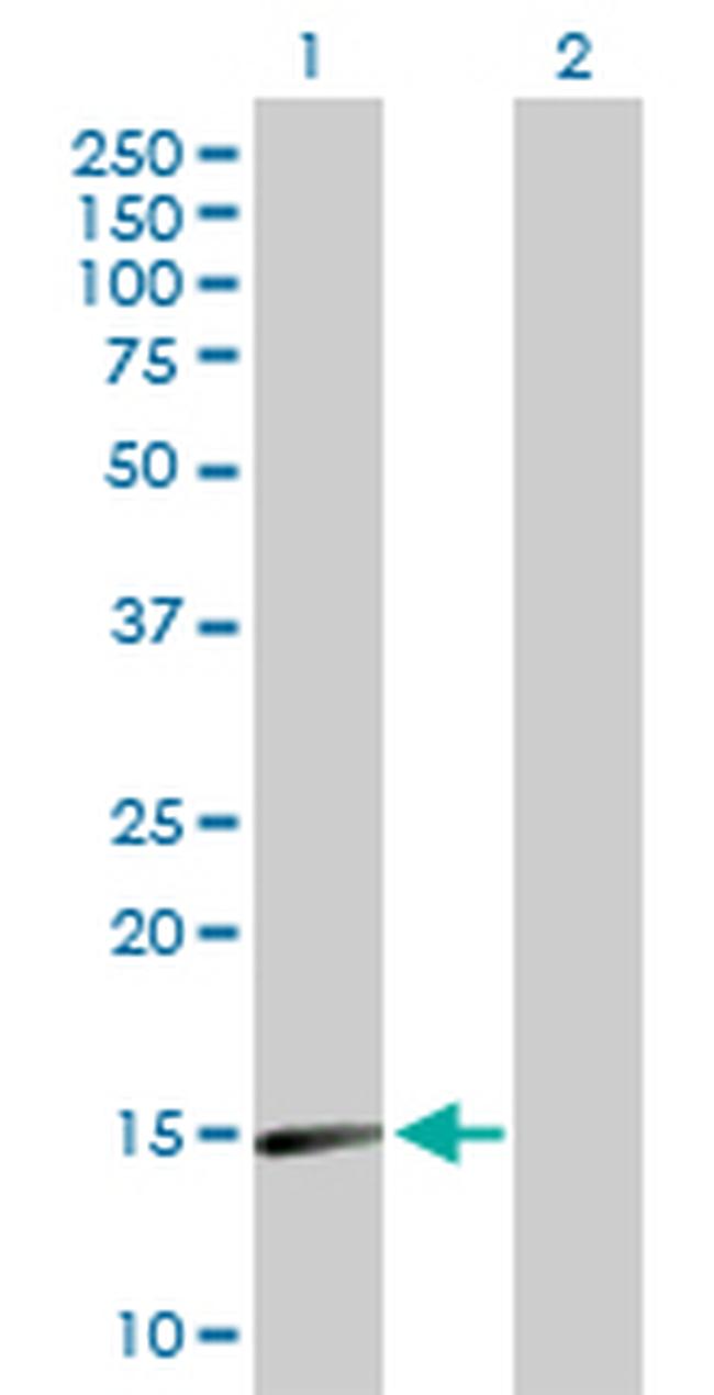 SNCA Antibody in Western Blot (WB)