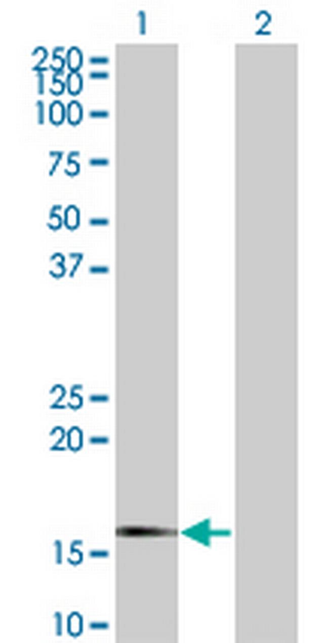 SNCG Antibody in Western Blot (WB)