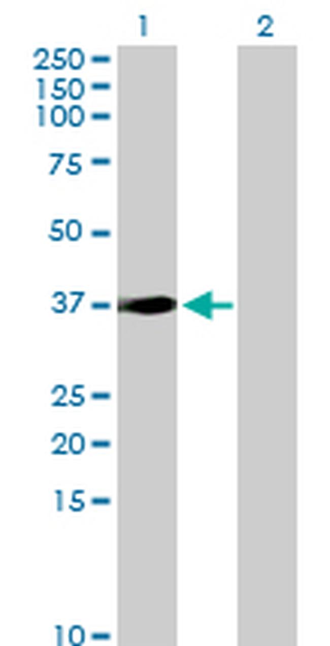 SORD Antibody in Western Blot (WB)