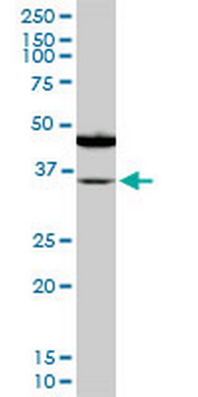 SORD Antibody in Western Blot (WB)