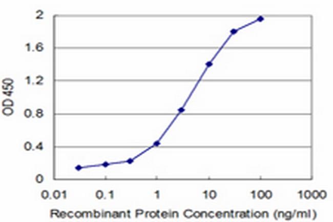 SORD Antibody in ELISA (ELISA)