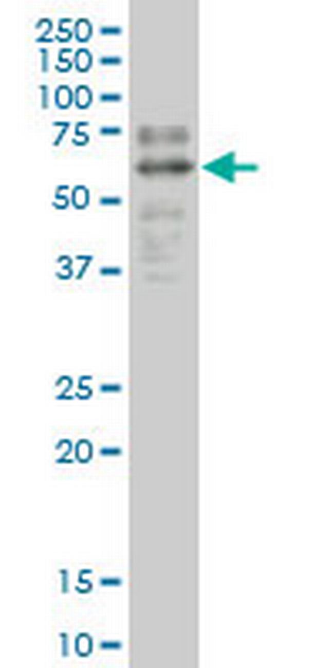 SOX9 Antibody in Western Blot (WB)