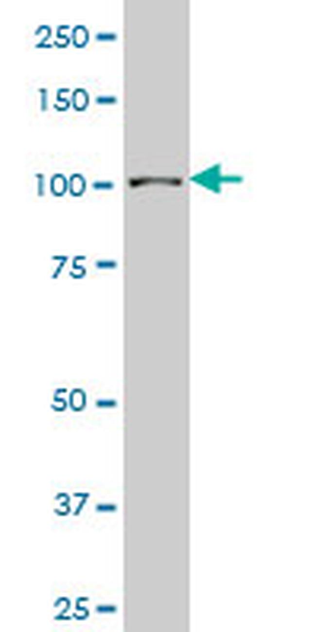 SP3 Antibody in Western Blot (WB)