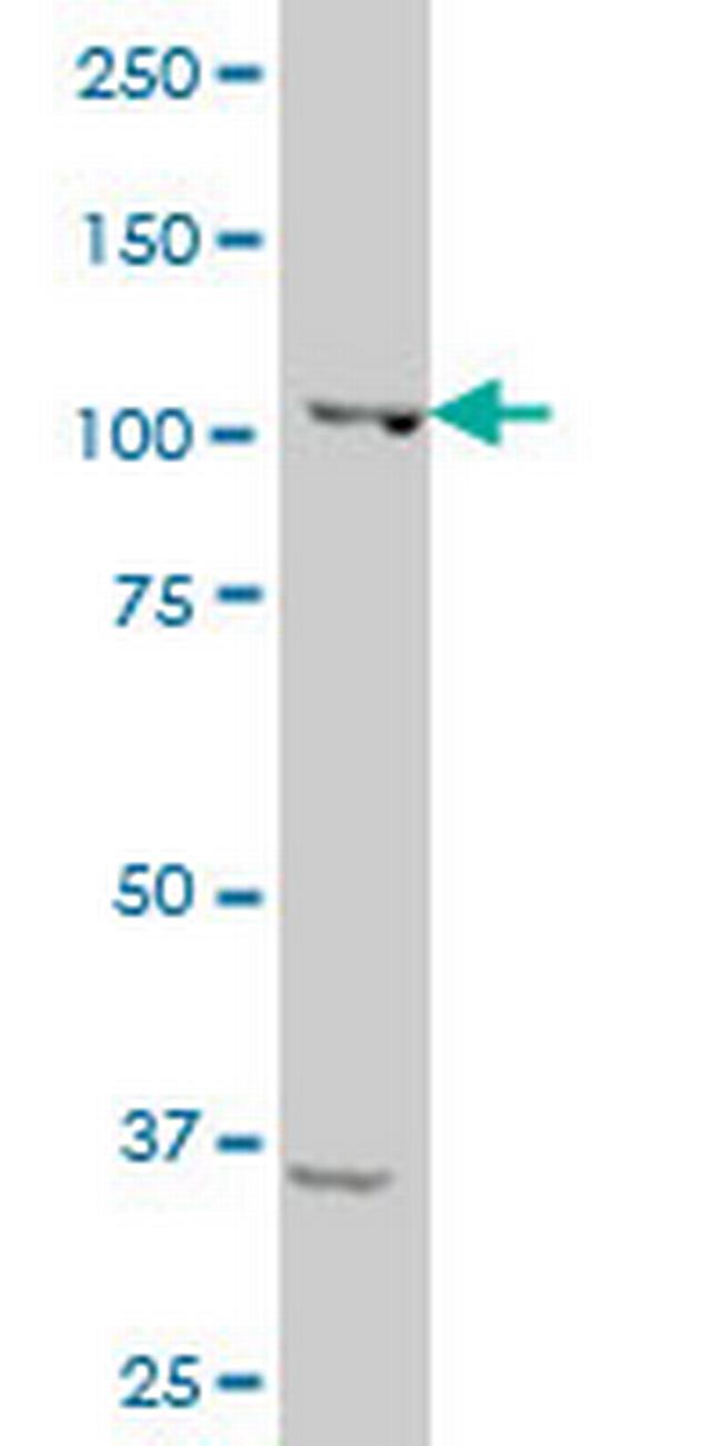 SP3 Antibody in Western Blot (WB)