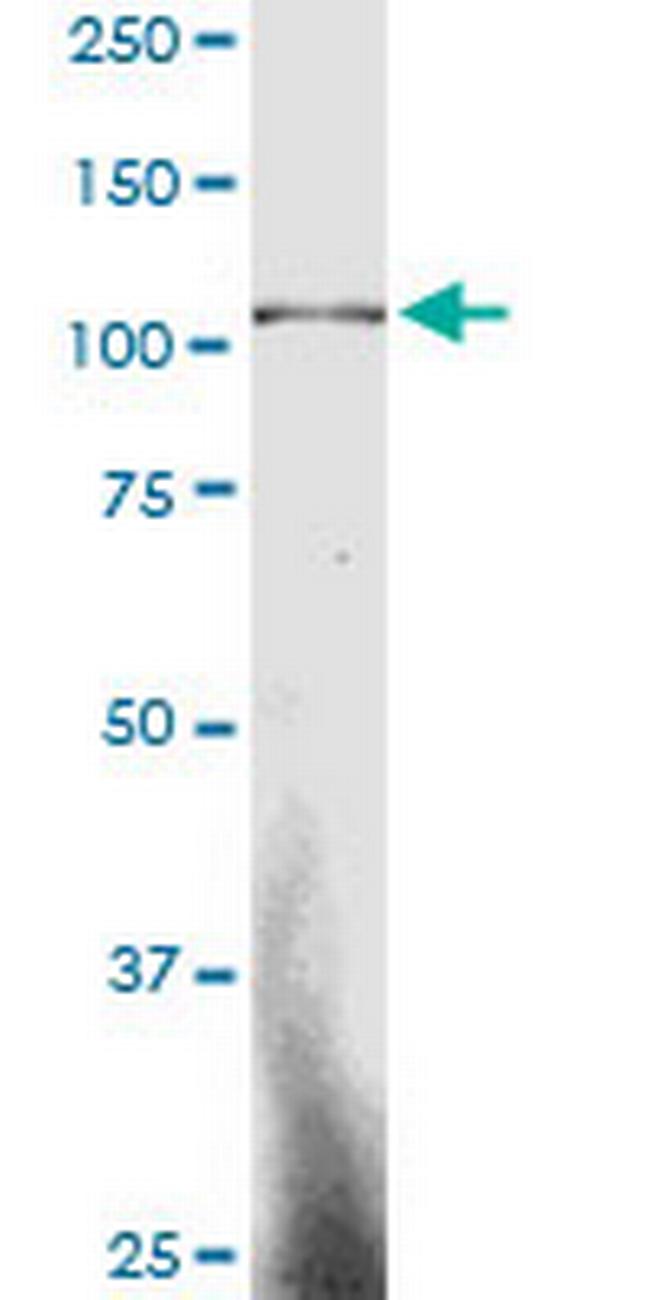 SP3 Antibody in Western Blot (WB)