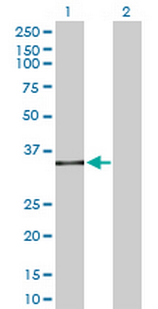 SPI1 Antibody in Western Blot (WB)