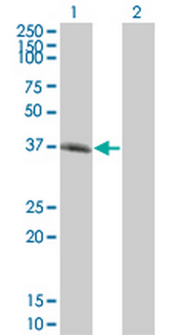 SPI1 Antibody in Western Blot (WB)