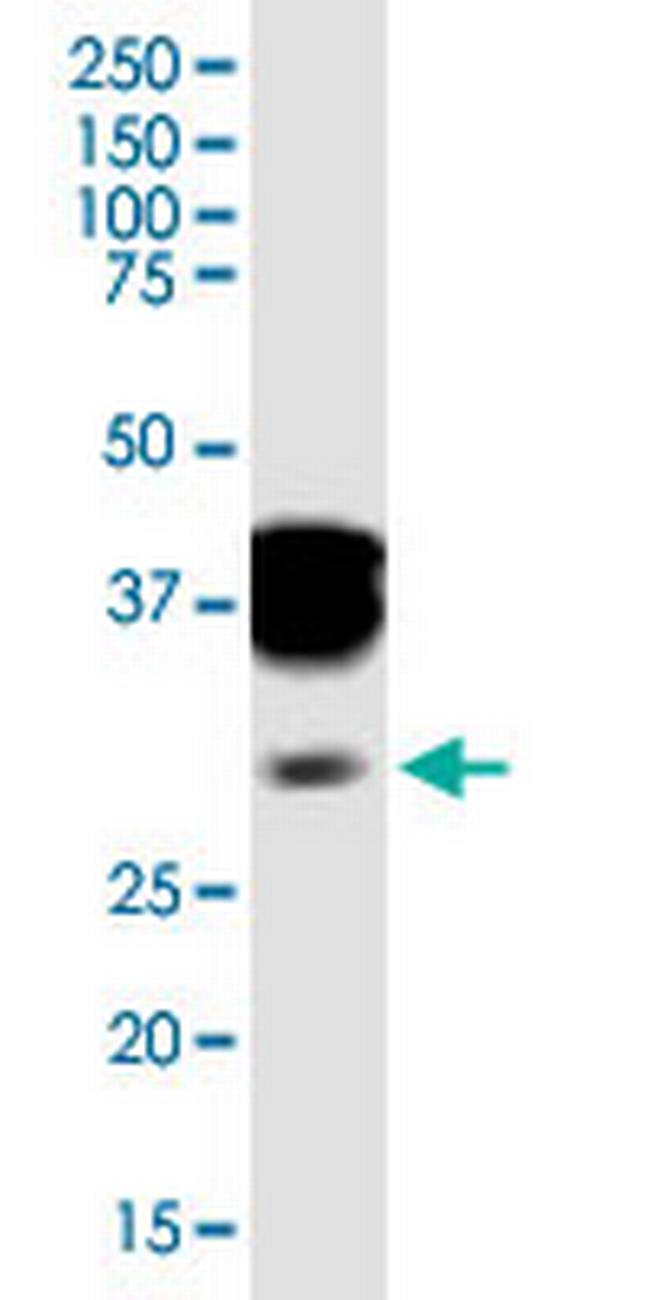 SPI1 Antibody in Western Blot (WB)