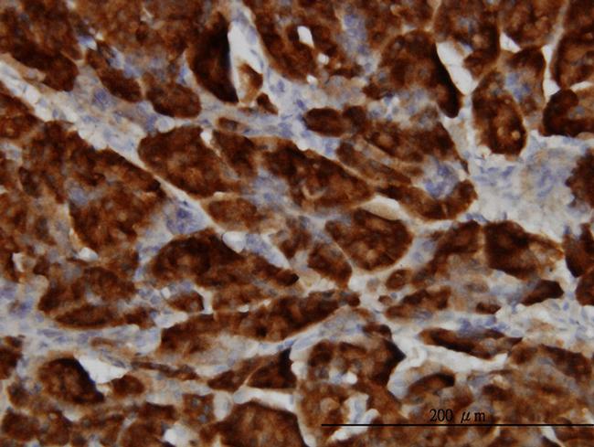 SPINK1 Antibody in Immunohistochemistry (Paraffin) (IHC (P))