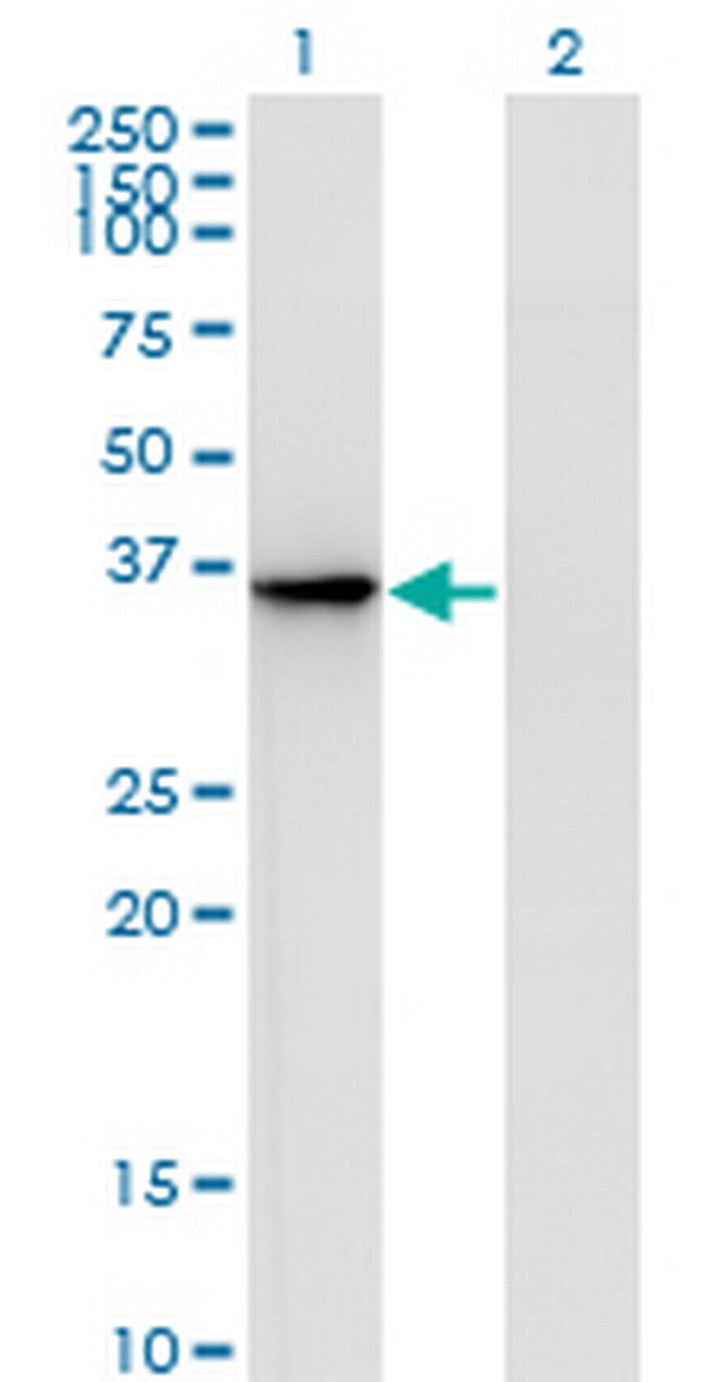 AKR1D1 Antibody in Western Blot (WB)