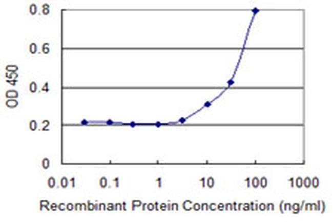 SSTR1 Antibody in ELISA (ELISA)