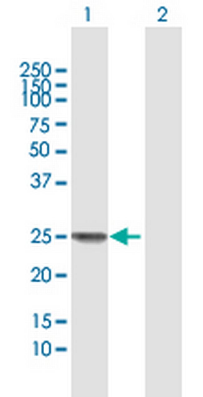 SSX1 Antibody in Western Blot (WB)