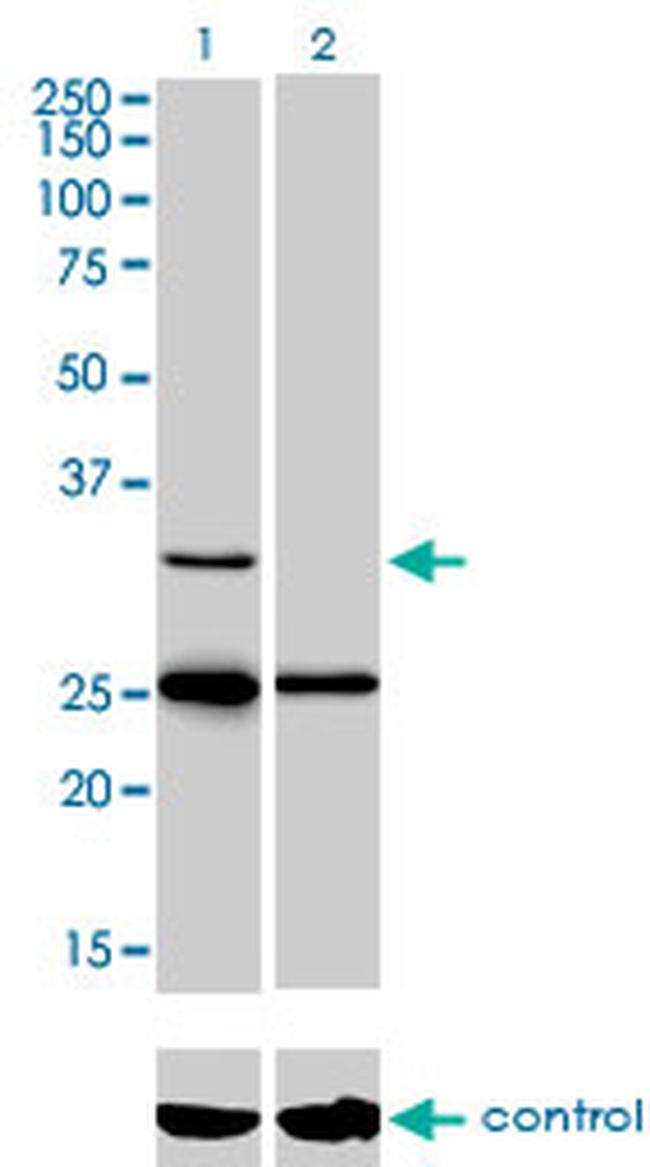 STAR Antibody in Western Blot (WB)