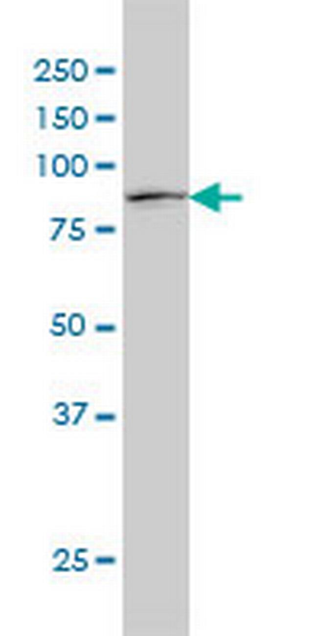 STAT1 Antibody in Western Blot (WB)