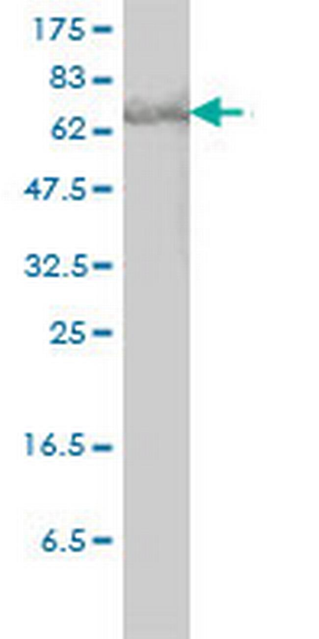 STAT3 Antibody in Western Blot (WB)