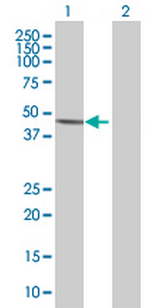 STAT5B Antibody in Western Blot (WB)