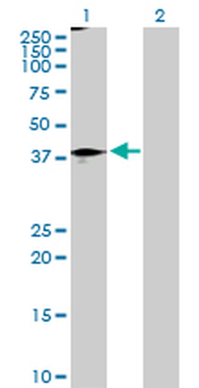 STAT5B Antibody in Western Blot (WB)