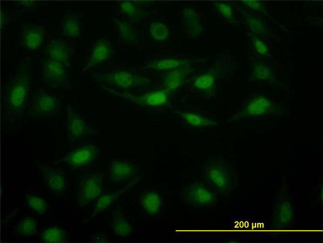 STAT5B Antibody in Immunocytochemistry (ICC/IF)