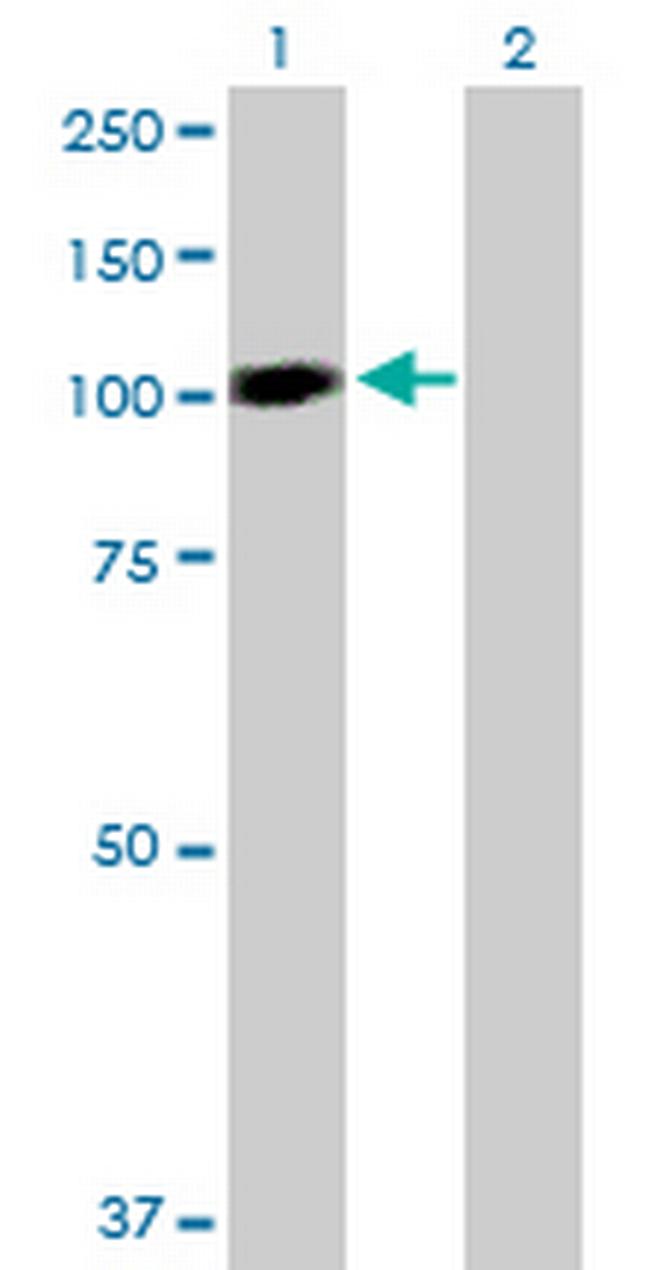 STAT6 Antibody in Western Blot (WB)