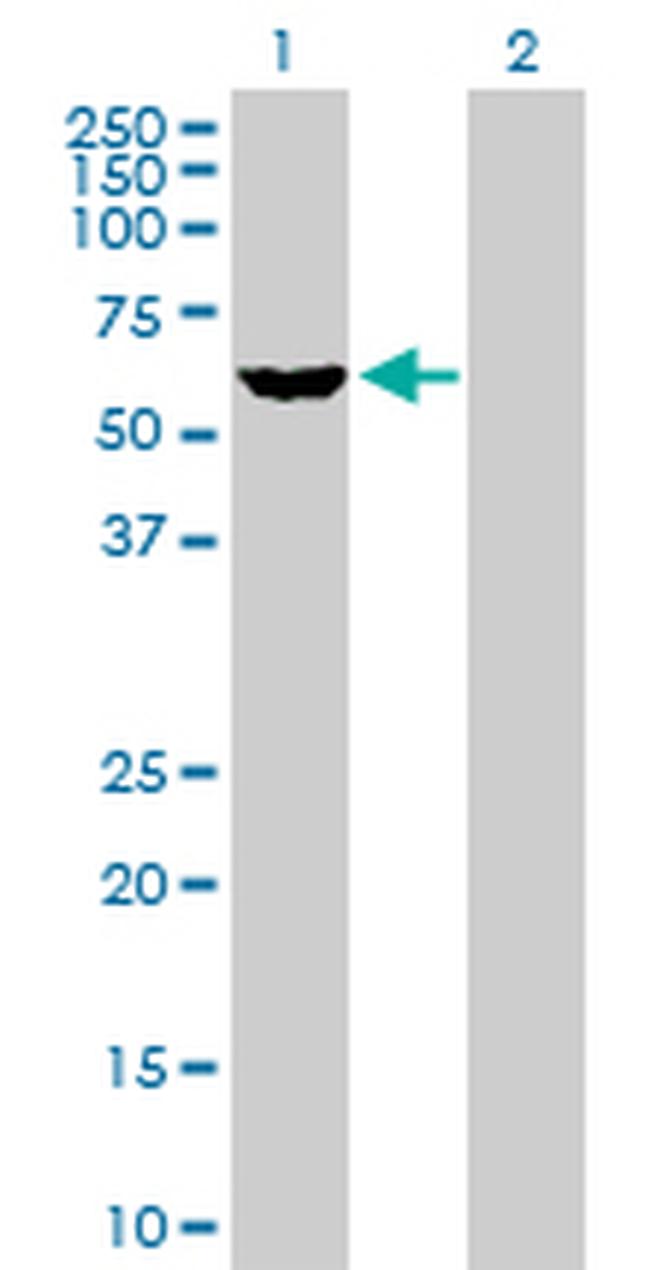 STAU1 Antibody in Western Blot (WB)