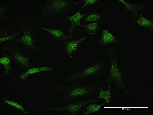 STK3 Antibody in Immunocytochemistry (ICC/IF)