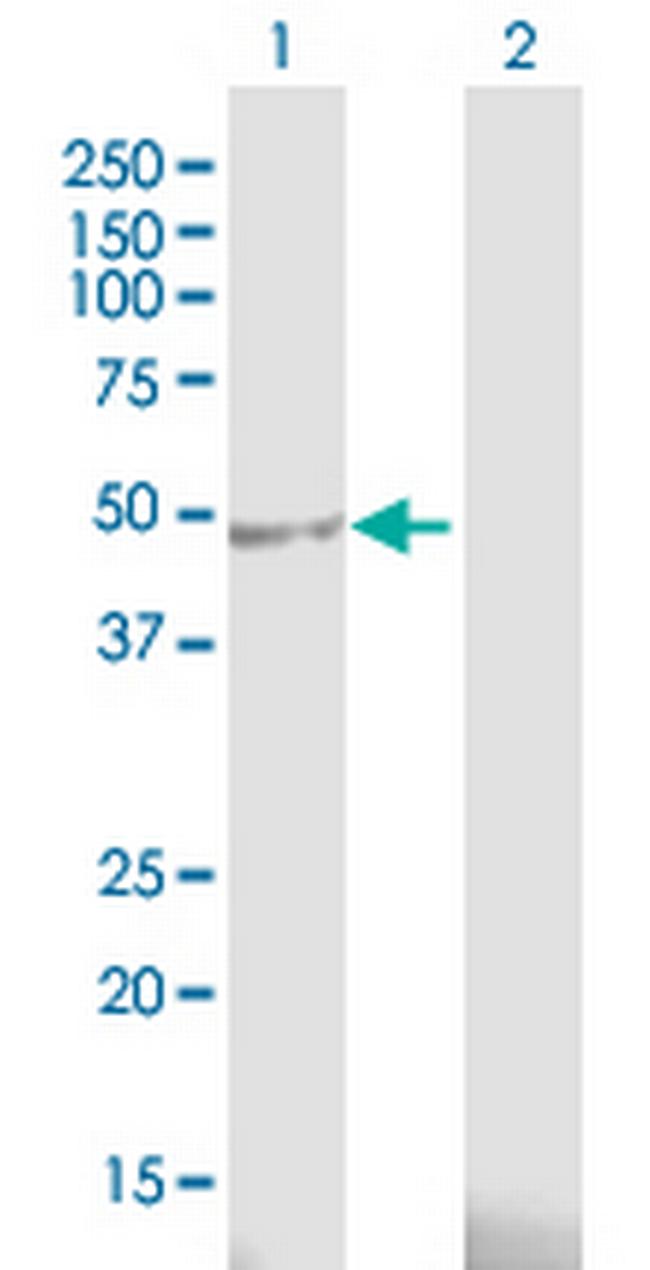 AURKA Antibody in Western Blot (WB)