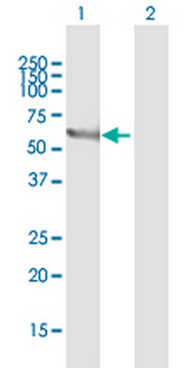 STXBP1 Antibody in Western Blot (WB)