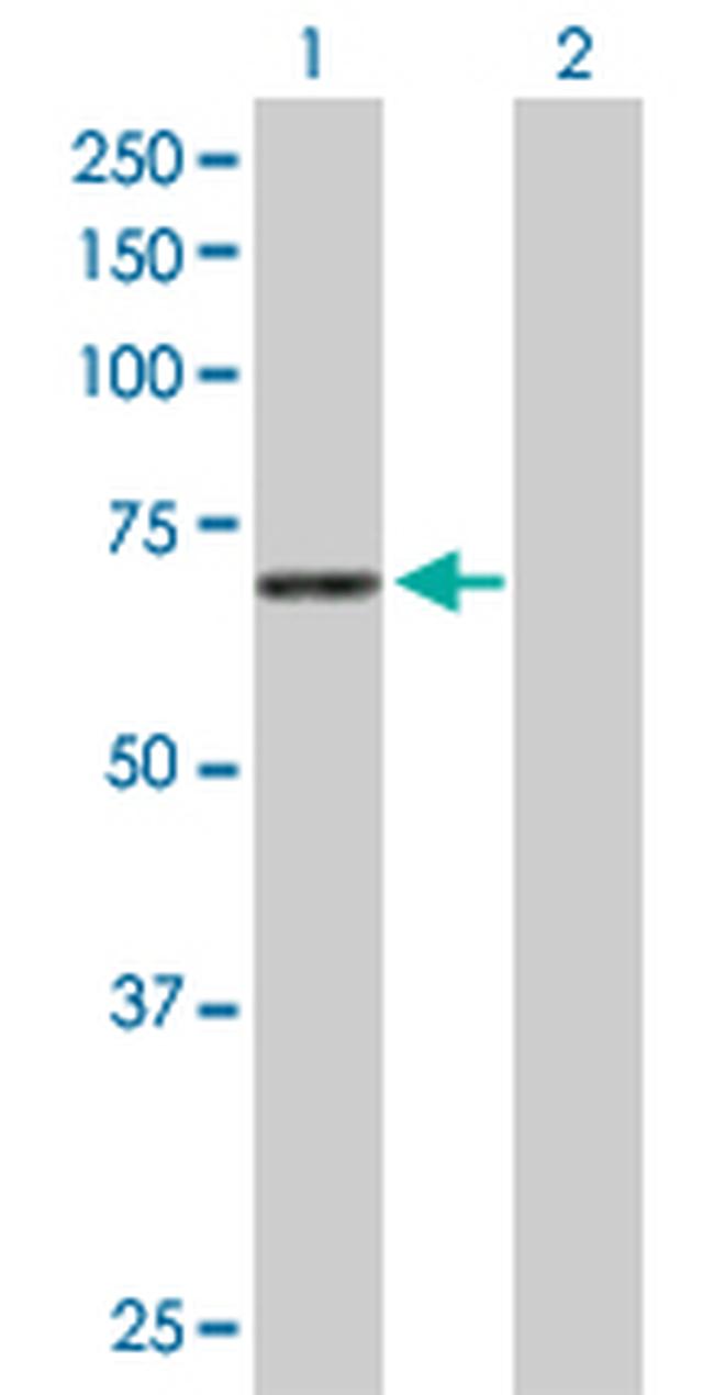 STXBP1 Antibody in Western Blot (WB)