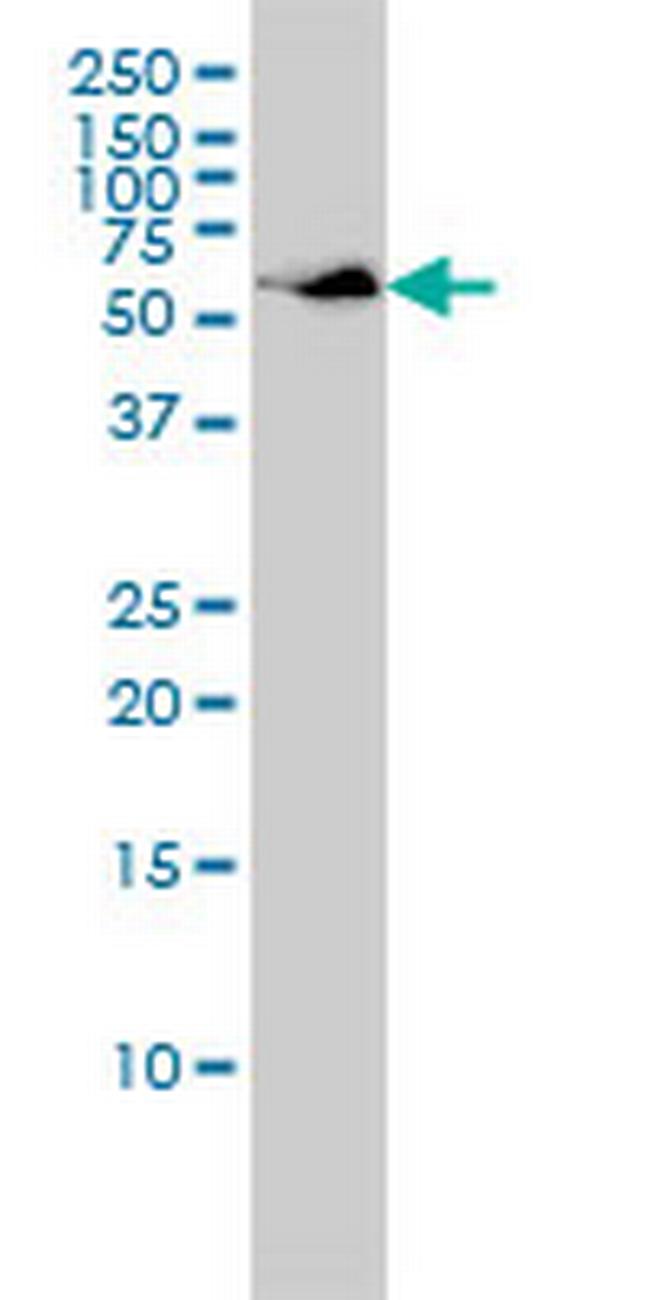 SUOX Antibody in Western Blot (WB)