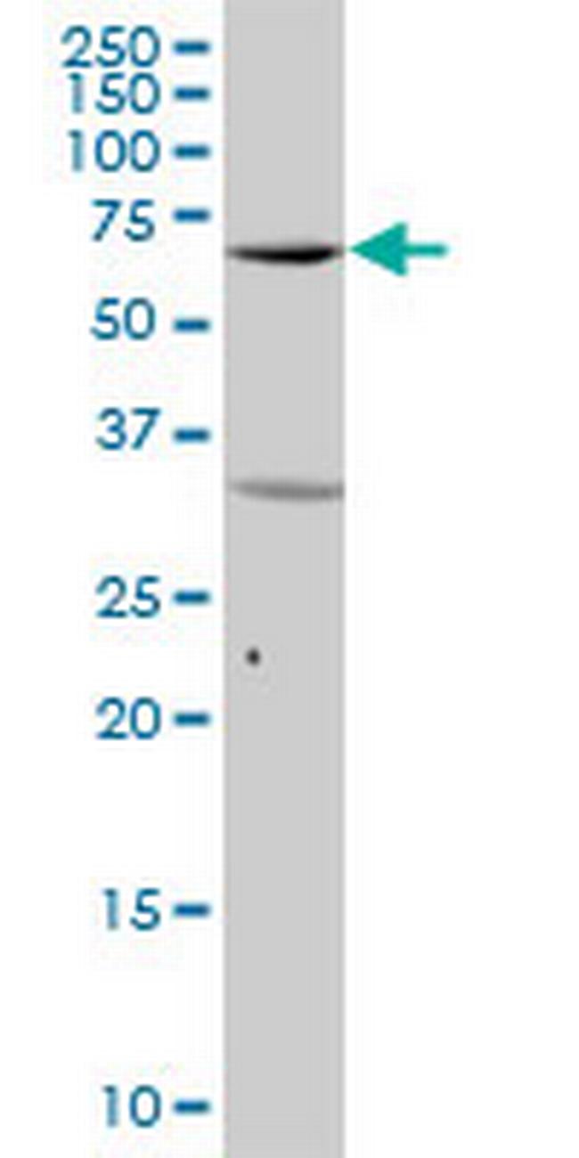 SYK Antibody in Western Blot (WB)