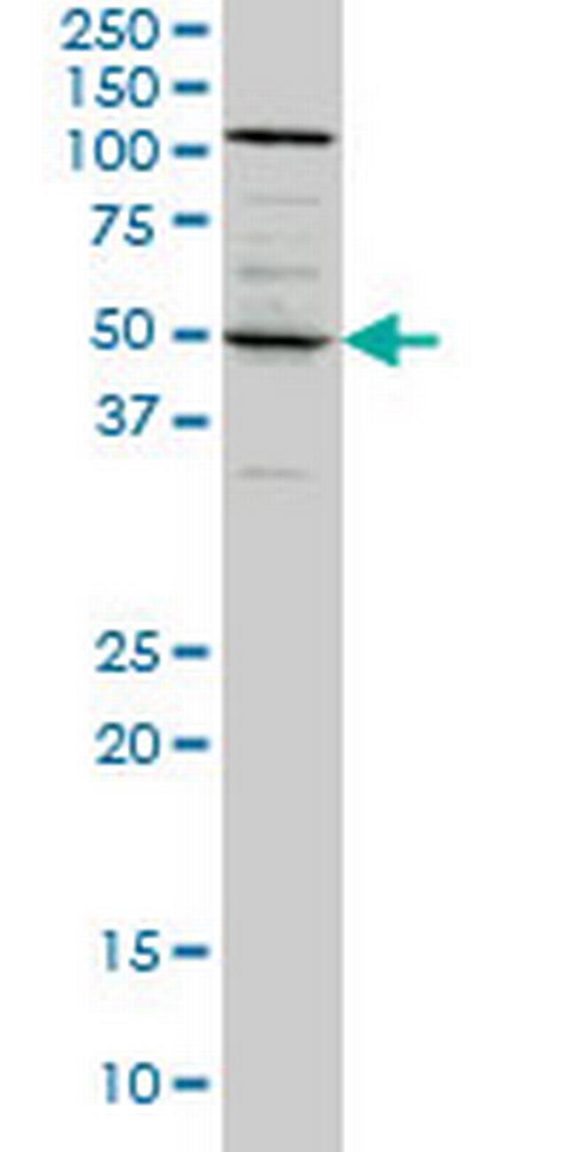 SYT4 Antibody in Western Blot (WB)