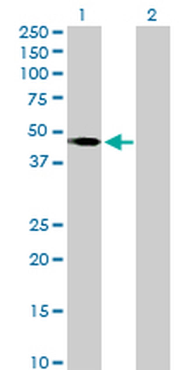 T Antibody in Western Blot (WB)