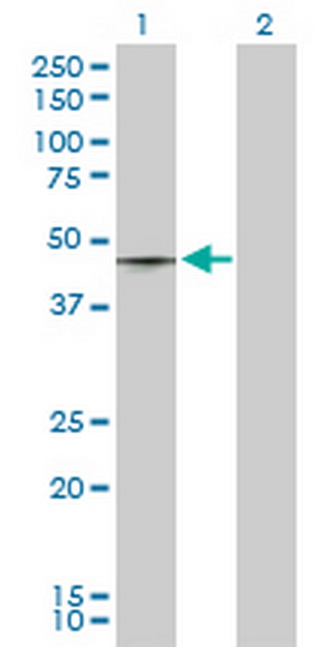 T Antibody in Western Blot (WB)