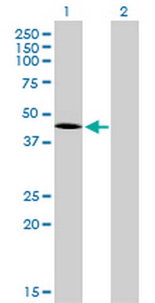 T Antibody in Western Blot (WB)