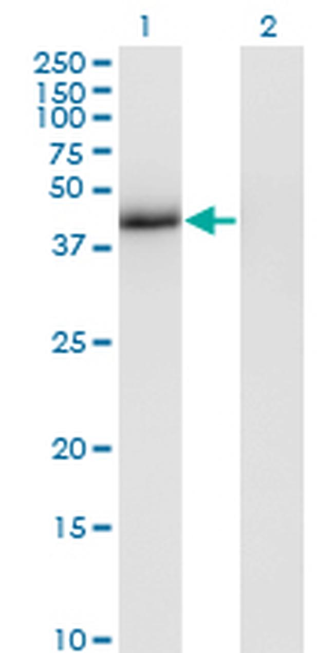 T Antibody in Western Blot (WB)