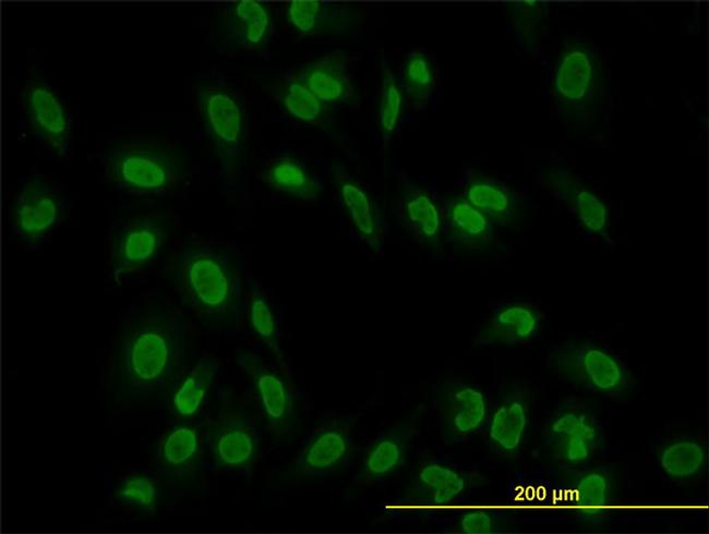 TAF11 Antibody in Immunocytochemistry (ICC/IF)